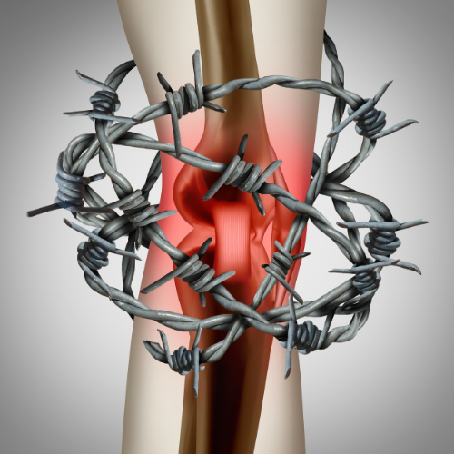 The Benefits of Cold Therapy Machines