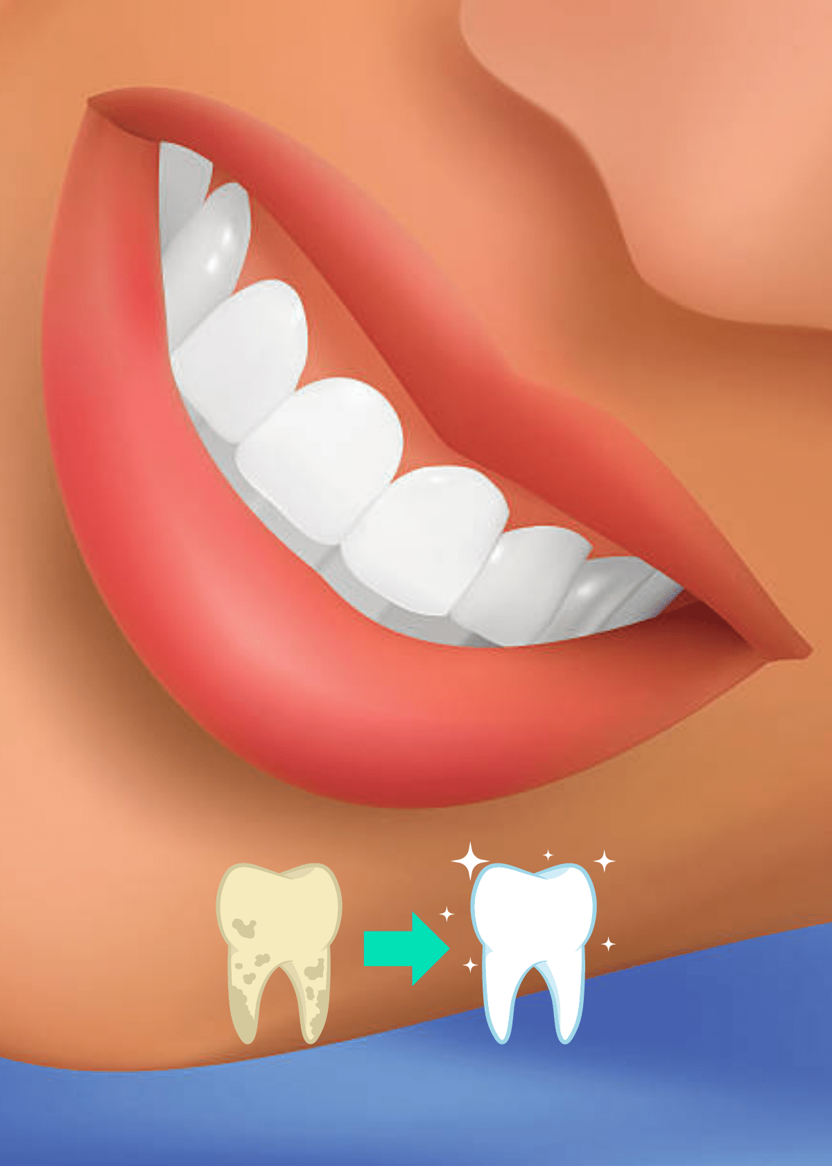 Teeth Whitening Grin